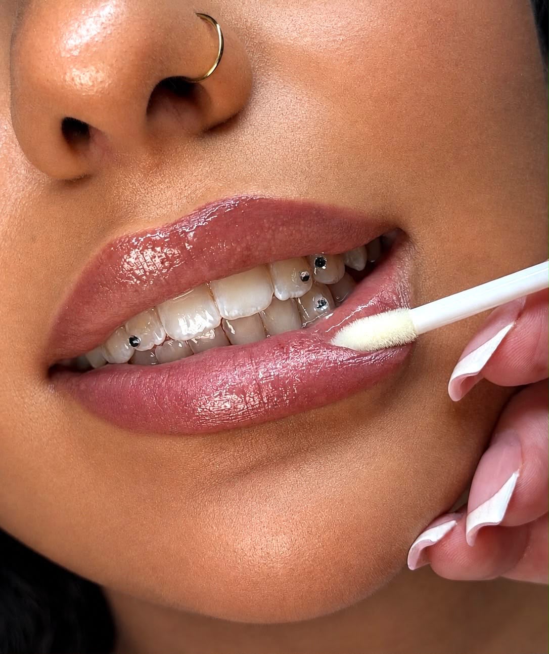 Tooth Gems