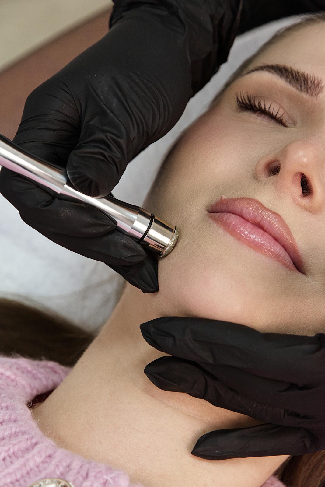 Mikrodermabrasion